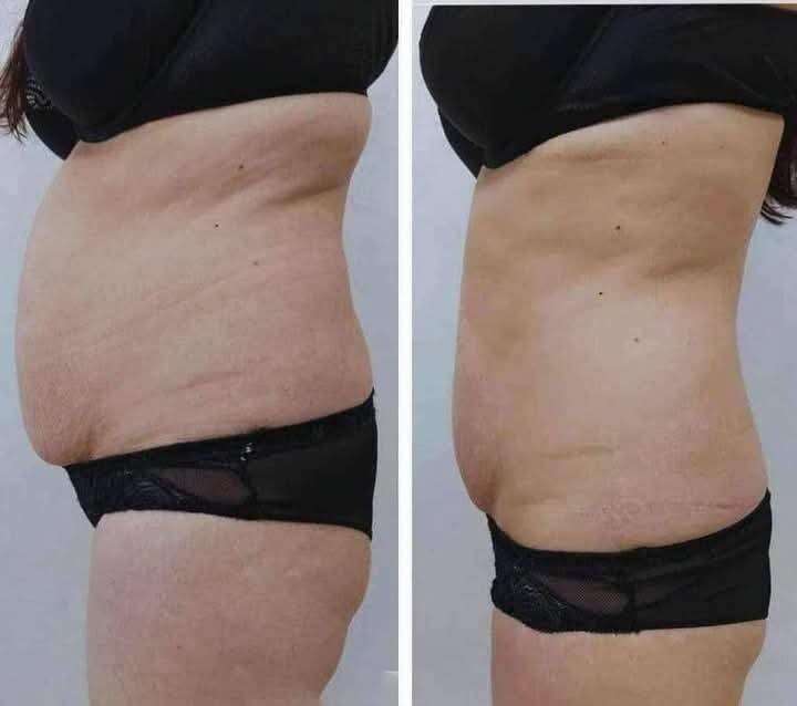 Body Contouring & Cellulite Care Ritual – 4-Step Professional Body Wrap Set